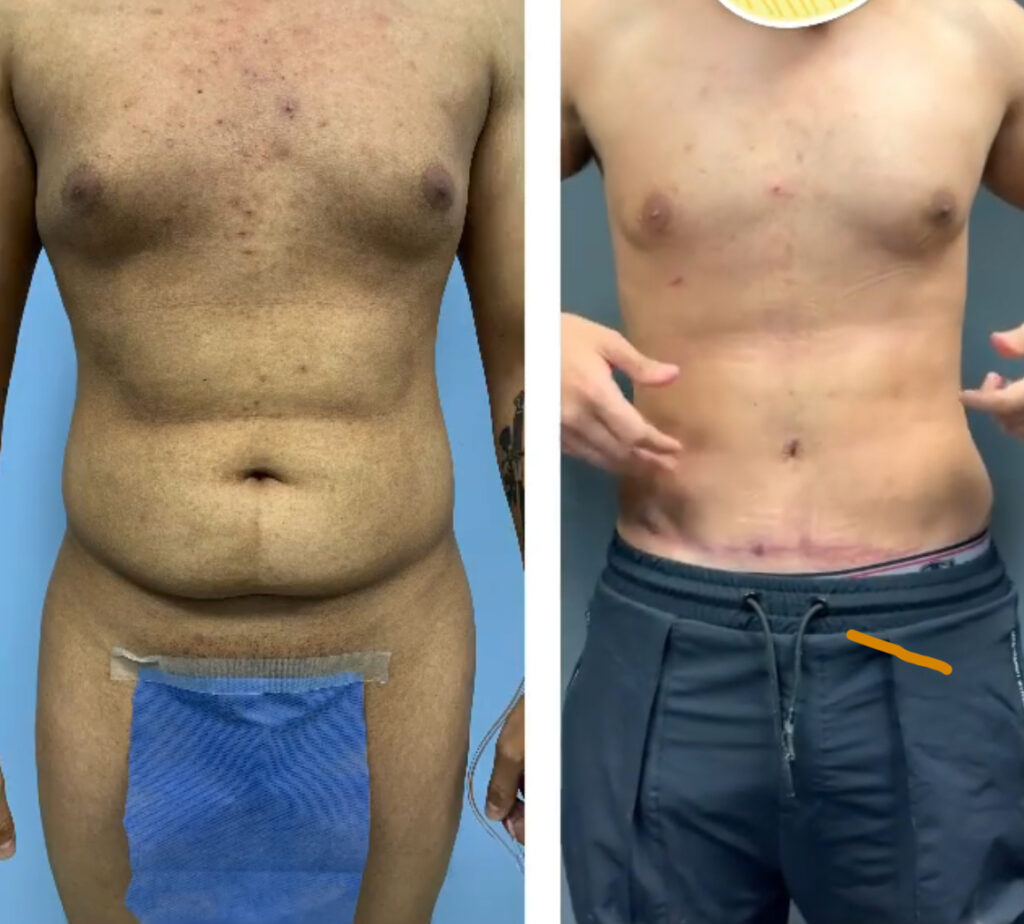 Daddy makeover by Dr. Ivan Aguilar & Dr. Carlos Mendez - before and after.